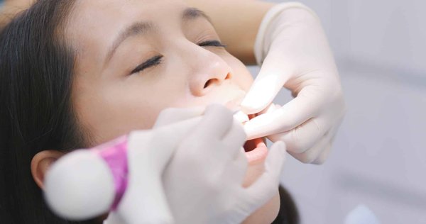 Urgence dentaire à montpellier : comment se règle une infection des gencives ?